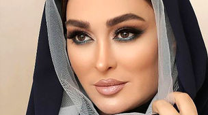 الهام حمیدی با تزریق جدید صورتش کلا یه آدم دیگه شد | الهام حمیدی با این عکس همه رو وحشت زده کرد 