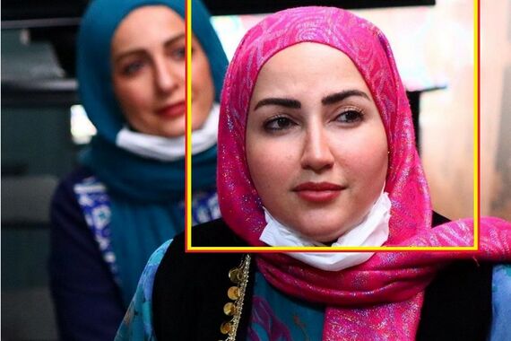 تغییر چهره 180 درجه نارین ایوبی بازیگر سریال نون خ بعد از 4سال
