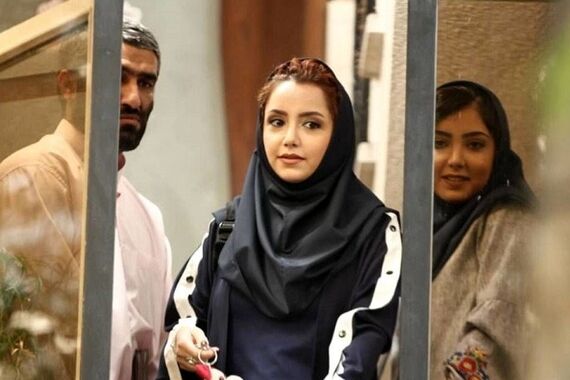 رونمایی نازنین بیاتی از چهره بعد از عمل بینی اش | خانم با این حرکت جدید کلا یه آدم دیگه شده