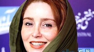 رونمایی ژاله صامتی از چهره بعد از عمل بینی اش | خانم با این تیپ گنگ تینیجریش همه رو مات خودش کرد