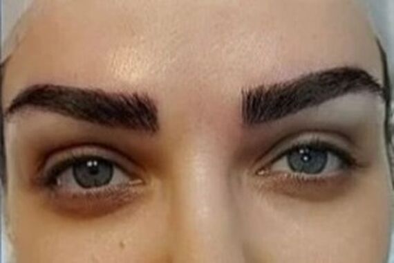 سلامت جسمی | پاکسازی موهای زائد با باقالی