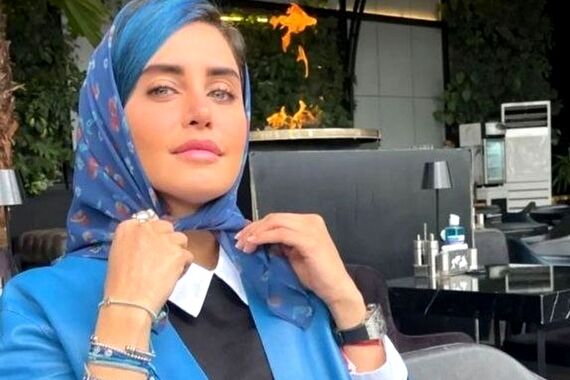 تیپ کوزتی الناز شاکردوست در ملاعام | خانم با این لباسای عجیبش حسابی سوژه شد