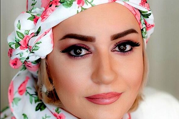 تصادف وحشتناک نعیمه نظام دوست | برای سلامتی نعیمه نظام دوست دعا کنید 
