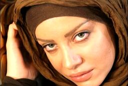 تزریق ژل لب باعث بیکاری خانم بازیگر شد + عکس