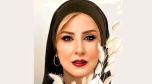 رونمایی مرجانه گلچین از چهره بعد از عمل زیبایی اش | خانم از وقتی صورتشو عمل کره ای کرده شده عین 20 ساله 